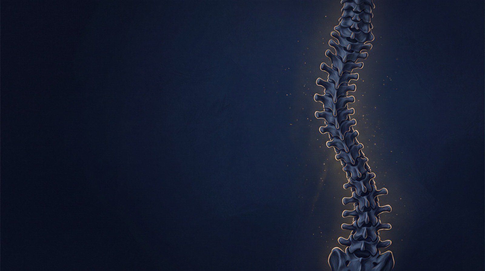 Human spine with a lateral scoliotic curve, vertebrae lit in gold — structural chiropractic care at Rochet Family Chiropractic, Royal Palm Beach FL