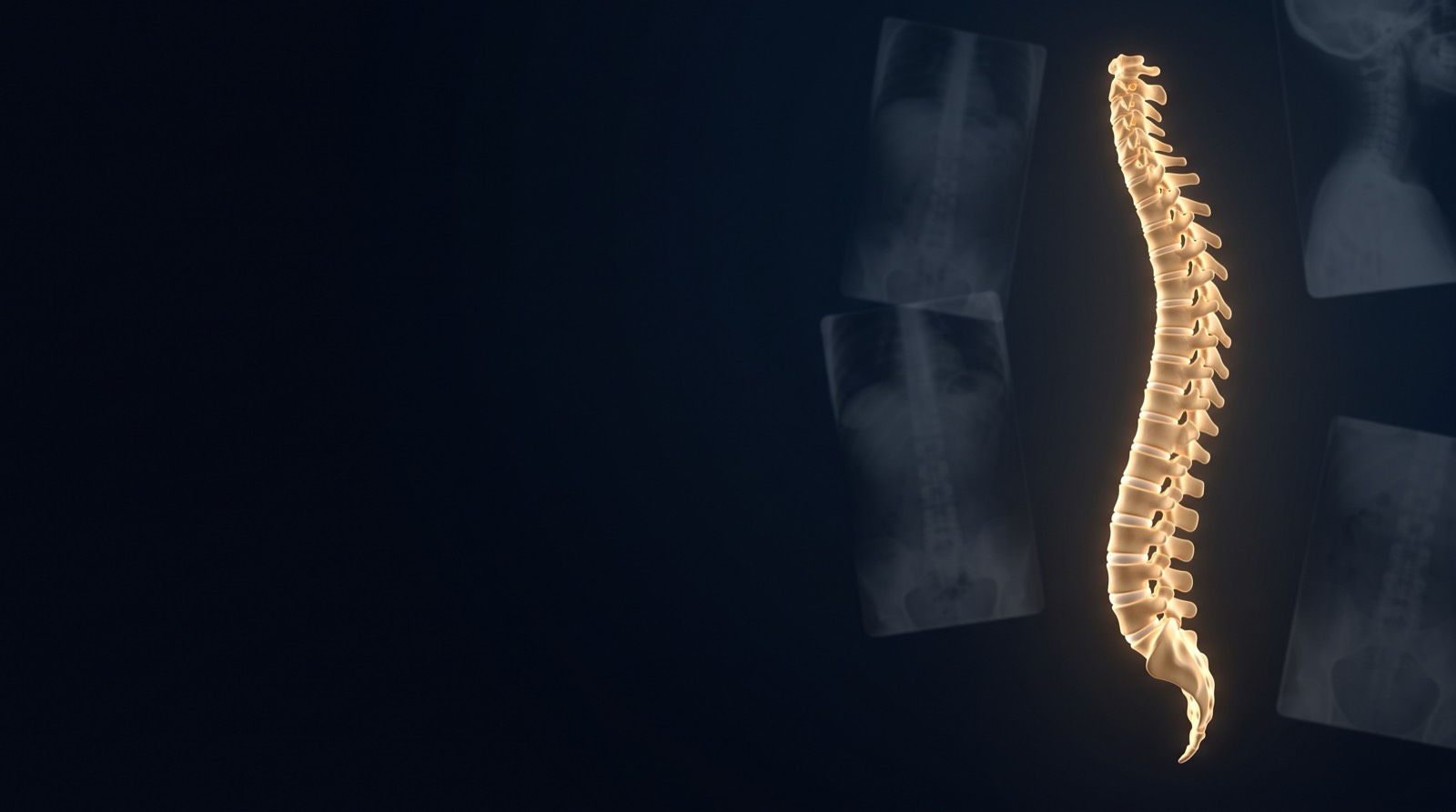A full human spine standing in balanced alignment, gold-lit against deep navy — X-ray-documented spinal correction at Rochet Family Chiropractic, Royal Palm Beach FL